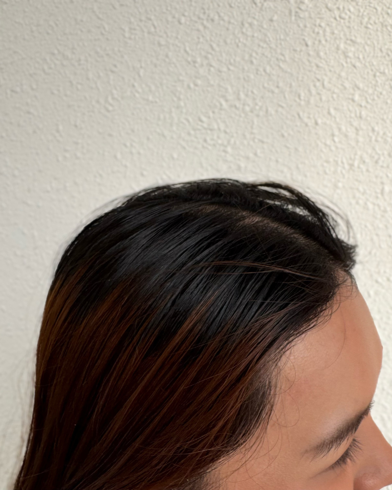 Before — oily hair